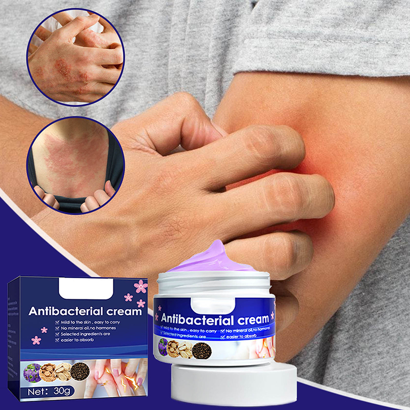 violet divine skin itching cream skin itching and itching relief mosquito bites topical cream
